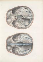 Planche 6 - Dure-mère encéphalique - Traité complet de l'anatomie de l'homme, par les Drs Bourgery e [...]