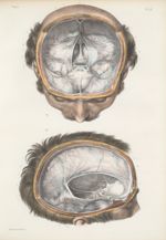 Planche 7 - Dure-mère encéphalique - Traité complet de l'anatomie de l'homme, par les Drs Bourgery e [...]