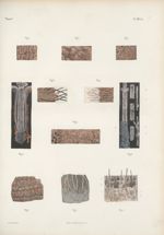 Planche 88 ter - Anatomie microscopique de la peau - Traité complet de l'anatomie de l'homme, par le [...]