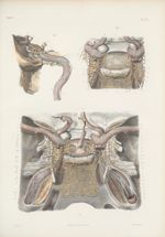 Planche 91 - Anatomie microscopique. Extrémité céphalique du grand sympathique. D'après les dessins  [...]