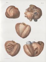 Planche 10 bis - Structure du coeur - Traité complet de l'anatomie de l'homme, par les Drs Bourgery  [...]