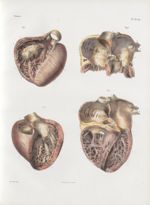 Planche 11 bis - Coupes des cavités du coeur - Traité complet de l'anatomie de l'homme, par les Drs  [...]
