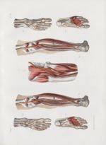 Planche 50 - Anomalies des artères du membre abdominal - Traité complet de l'anatomie de l'homme, pa [...]