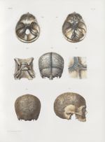 Planche 72 - Sinus cérébraux et canaux veineux des os du crâne - Traité complet de l'anatomie de l'h [...]