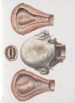 Planche 74 - Utérus après la gestation - Traité complet de l'anatomie de l'homme, par les Drs Bourge [...]