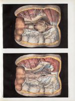 Planche 3 - Anatomie chirurgicale. Plans musculaires, aponévroses, vaisseaux et nerfs du périnée - T [...]