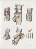 Planche 29 - Phlébotomie. Saignées du bras et du pied - Traité complet de l'anatomie de l'homme, par [...]