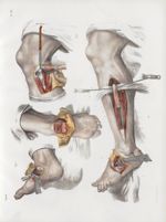 Planche 61 - Résections - Traité complet de l'anatomie de l'homme, par les Drs Bourgery et Claude Be [...]