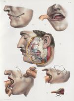 Planche 20 - Opérations qui ont rapport à la fistule salivaire - Traité complet de l'anatomie de l'h [...]