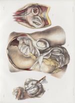 Planche 39 - Anatomie chirurgicale des hernies - Traité complet de l'anatomie de l'homme, par les Dr [...]