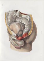 Planche 51 - Anatomie chirurgicale des voies urinaires dans l'homme - Traité complet de l'anatomie d [...]