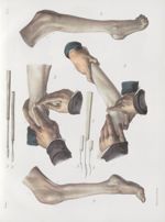 Planche L - Instrumens de ténotomie de M. J. Guérin - Traité complet de l'anatomie de l'homme, par l [...]