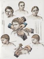 Planche M - Instrumens de ténotomie de M. J. Guérin - Torticolis - Traité complet de l'anatomie de l [...]