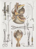 Planche XVII - Opérations sur les organes génitaux urinaires de l'homme ; opérations sur la vessie ; [...]