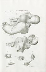 Malattie dell' ovaia. Gravidanza estra-uterina - Atlante generale della anatomia patologica del corp [...]