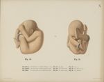 Fig. 14. - Von links. Fig. 15. - Von vorn. VII. Monat. Dasselbe Kind in Natürlicher Haltung in utero [...]