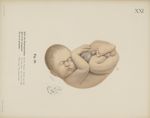 Fig. 28. - Ende der Schwangerschaft. Dasselbe Präparat. Ansicht von rechts - Uterus und Kind von der [...]
