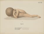 Fig. 35. - Ende der Schwangerschaft. Dasselbe Präparat: Kind von vorn - Uterus und Kind von der erst [...]