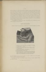 Fig. 6. La coupe des portions du col et de la portion attenante du Placenta - Étude anatomique sur l [...]