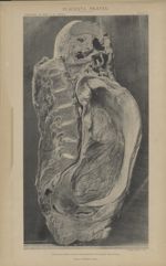 Coupe juxta médiane, verticale, antéro-postérieure (moitié gauche vide du fœtus) - Étude anatomique  [...]
