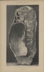 Coupe juxta médiane, verticale, antéro-postérieure (moitié droite vide du fœtus) - Étude anatomique  [...]
