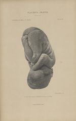 Le segment fœtal extrait de la moitié droite de la coupe et vu de droite - Étude anatomique sur l'in [...]