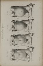 Pl. XXV. - Histoire de la grossesse. Fig. 1. - Etat naturel / Fig. 2. - 3 mois / Fig. 3. - 6 mois /  [...]