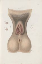 PL. X. Fig. 1 - [pubis, vulve, périnée, anus] - Nouvelles démonstrations d'accouchements