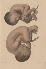 PL. XVIII - [évolution du foetus]. Fig. 1 - 7 mois / Fig. 2 - 9 mois - Nouvelles démonstrations d'ac [...]