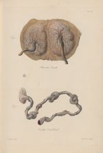 PL. XX. Fig. 1 - placenta double / Fig. 2 - cordon ombilical - Nouvelles démonstrations d'accoucheme [...]
