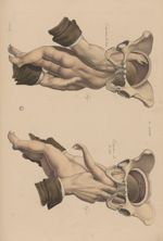 PL. XXXVIII. Fig. 1 - extraction des bras / Fig. 2 - extraction de la tête - Nouvelles démonstration [...]
