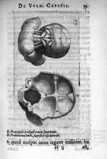 A. Os occipitis à reliquorum cranio separatum / B. Prominentes limbi, superficiè ossis internà - Pet [...]