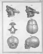 Fig. 1 et 2. Partie de la face et du crâne (intérieur de la cavité orbitaire et fosse zygomatique) / [...]