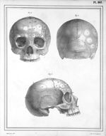 Manuel d'anatomie descriptive du corps humain, représentée en planches lithographiées. Tome III