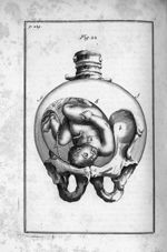 Fig. 22. L'enfant [dans la matrice], dont la tête s'applique aux os pubis, & dont l'epaule panche ve [...]