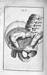 Fig. 33. L'enfant bien tourné dans l'uterus - Observations importantes sur le manuel des accouchemen [...]