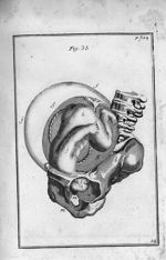 Fig. 35. L'enfant, les epaules appuyées sur les os pubis - Observations importantes sur le manuel de [...]