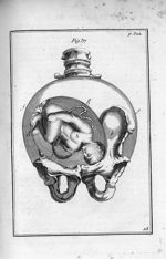 Fig. 37. L'enfant dans l'uterus, couché sur le ventre, la tête appuyée contre les os des îles, & l'o [...]