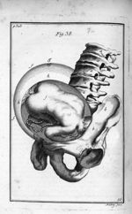 Fig. 38. L'enfant dans la matrice, dont la tête se presente à l'orifice près de l'os des îles gauche [...]