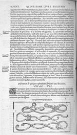 Fig. 143. [Ligatures] - Les Oeuvres d’Ambroise Paré, conseiller et premier chirurgien du roy, divisé [...]