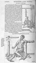 Fig. 155-156. Figure dudict Ambi, ensemble la situation du malade - Les Oeuvres d’Ambroise Paré, con [...]