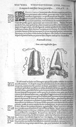 Fig. 226. [nez artificiels] - Les Oeuvres d’Ambroise Paré, conseiller et premier chirurgien du roy,  [...]