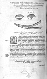 Fig. 229. Autres obturateurs du palais - Les Oeuvres d’Ambroise Paré, conseiller et premier chirurgi [...]