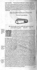 Fig. 234. Figure d'un poulcier de fer blanc pour tenir le pouce eslevé - Les Oeuvres d’Ambroise Paré [...]