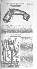 Fig. 238. Description du bras de fer / Fig. 239. Pourtraict des jambes artificielles - Les Oeuvres d [...]