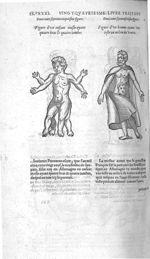 Fig. 275. Enfant masle ayant quatre bras & quatre iambes / Fig. 276. Homme ayant une teste au milieu [...]