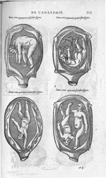 Fig. 243-244-245-246 - Les Oeuvres d’Ambroise Paré, conseiller et premier chirurgien du roy, divisée [...]