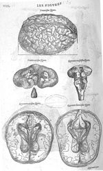 Fig. 30, 31, 41, 42 et 43. Cerveau - Les Oeuvres d’Ambroise Paré, conseiller et premier chirurgien d [...]
