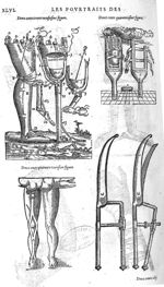 Fig. 239-240-241 - Les Oeuvres d’Ambroise Paré, conseiller et premier chirurgien du roy, divisées en [...]