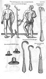 Fig. 242-247-248-249-250 - Les Oeuvres d’Ambroise Paré, conseiller et premier chirurgien du roy, div [...]